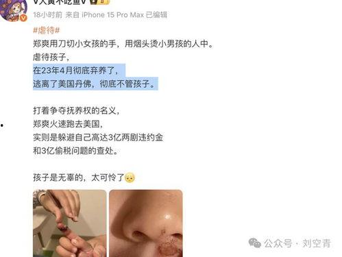 吃瓜爆料免费进,吃瓜爆料免费进，揭秘娱乐圈幕后真相！