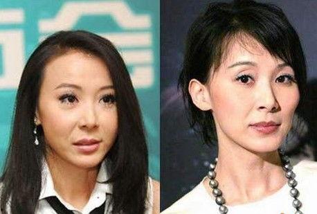 整容失败明星网红,明星网红的美丽代价