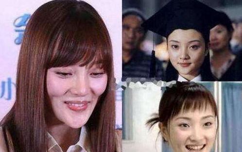 整容失败明星网红,明星网红的美丽代价