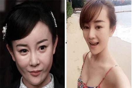 整容失败明星网红,明星网红的美丽代价