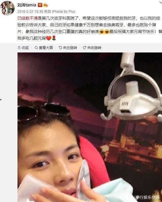 明星网红修复牙齿,揭秘明星美齿秘籍